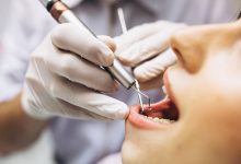 Фото - Стоматолог объяснила, можно ли беременным лечить зубы